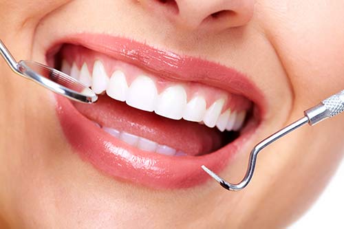 Lowest Cost Professional Teeth Whitening Service