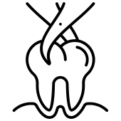 Teeth Extraction