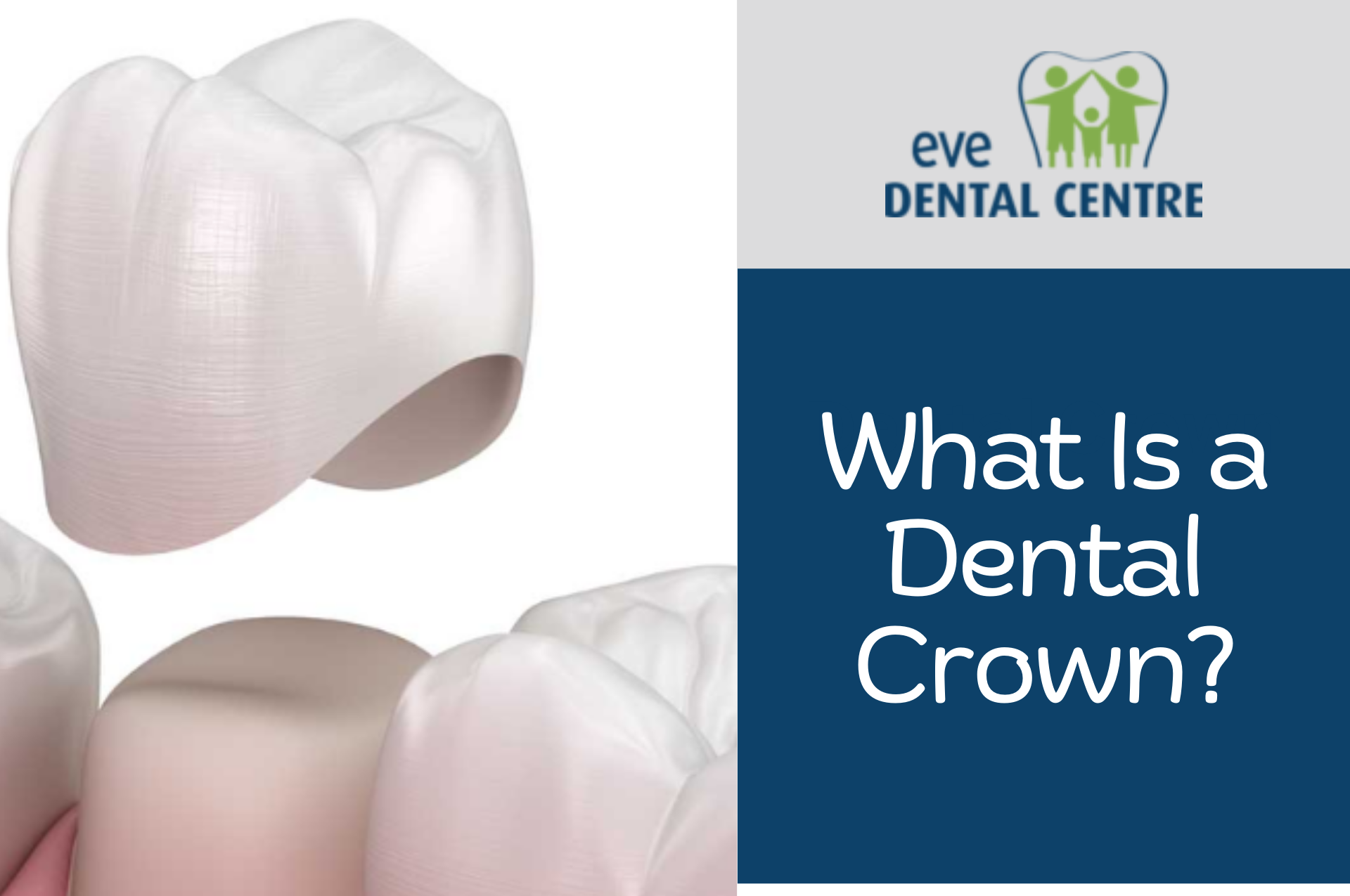 What Is a Dental Crown