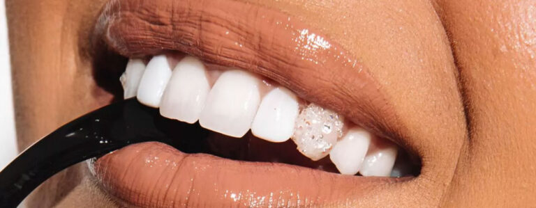 Are Tooth Gems Safe Procedure, Cost & Aftercare Guide