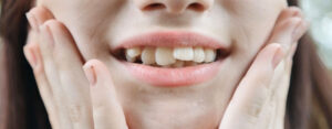 Can You Get Veneers on Crooked Teeth