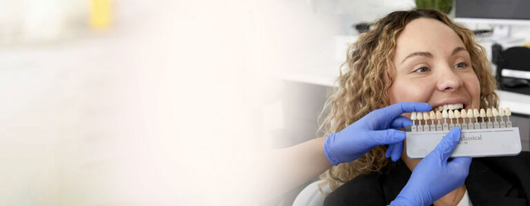 How to Keep Your Veneers Looking New