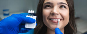 Veneers Everything You Need to Know Before Treatment