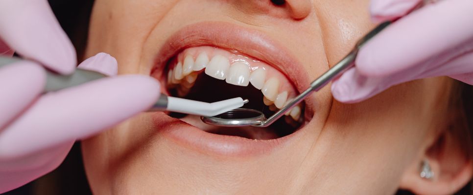 How Antibiotics Treat Tooth Infections