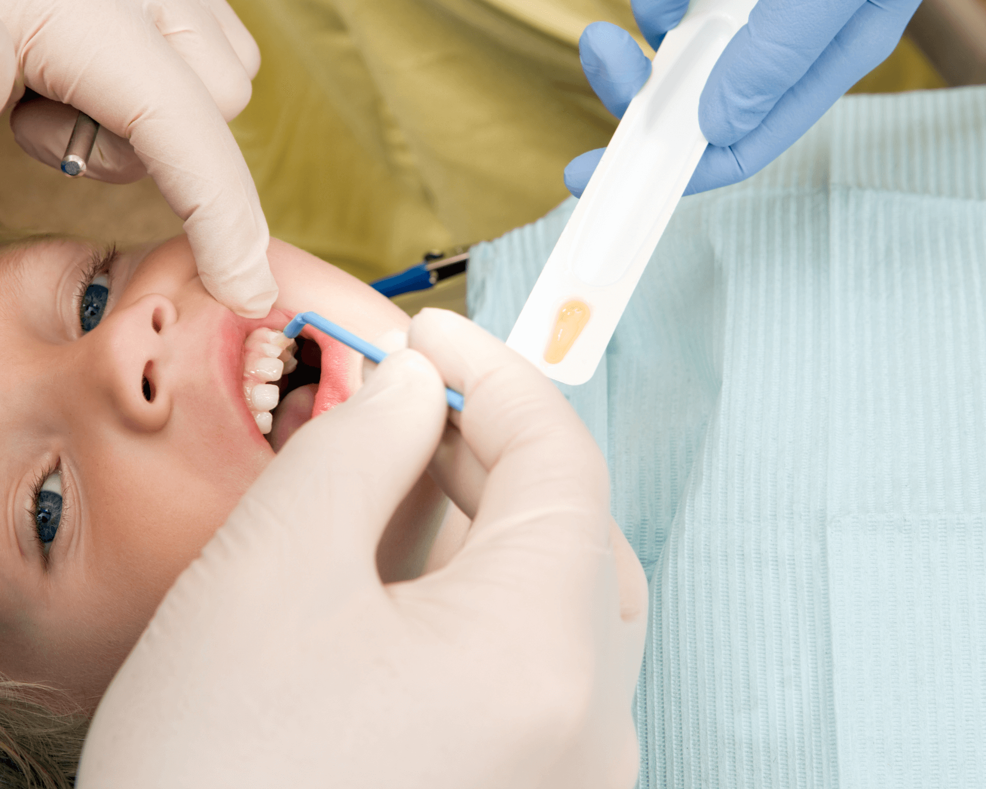 What is Considered a Dental Emergency